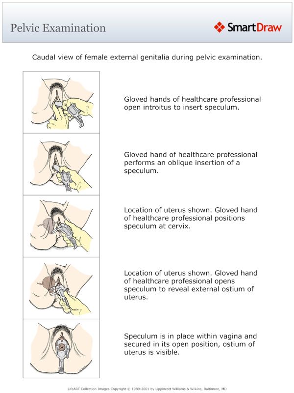 Pelvic_Examination