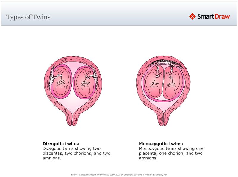 Types_of_Twins2