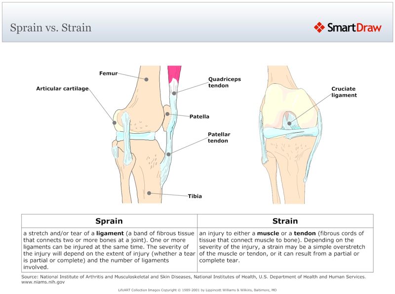 Sprain_vs._Strain