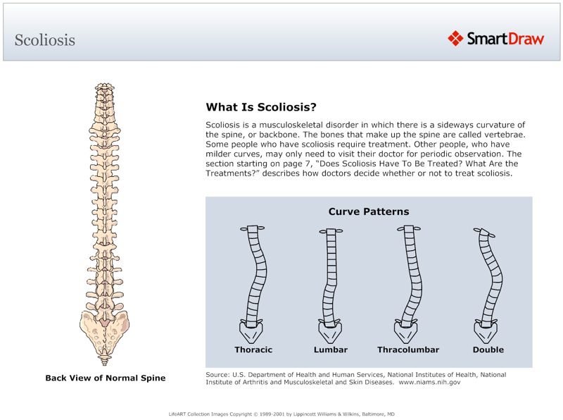 Scoliosis