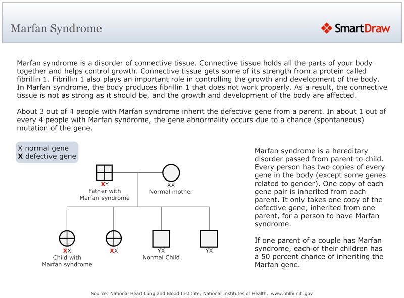 Marfan_Syndrome