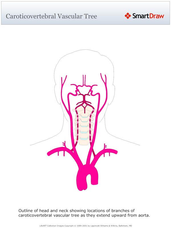 Caroticovertebral_Vascular_Tree
