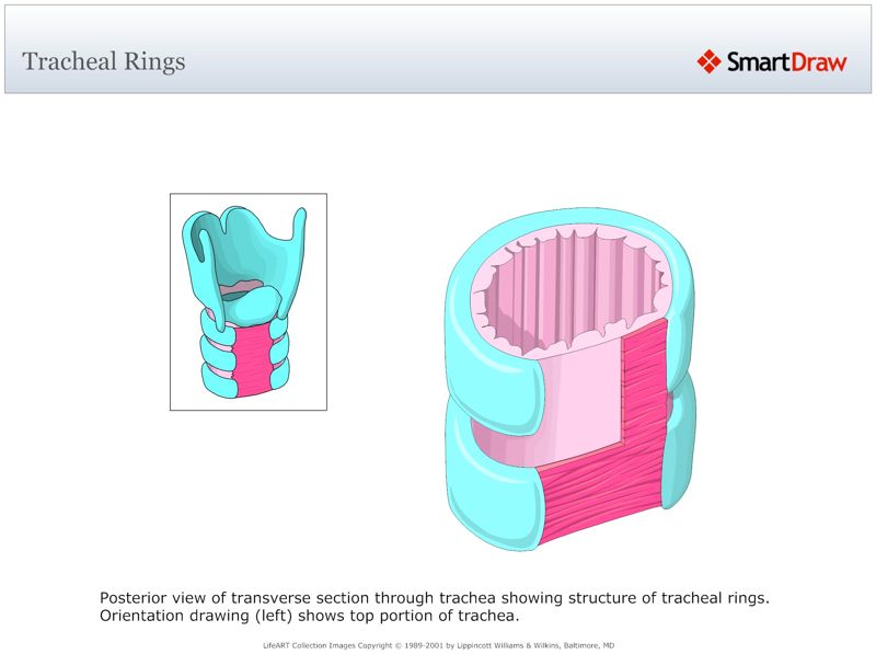Tracheal_Rings