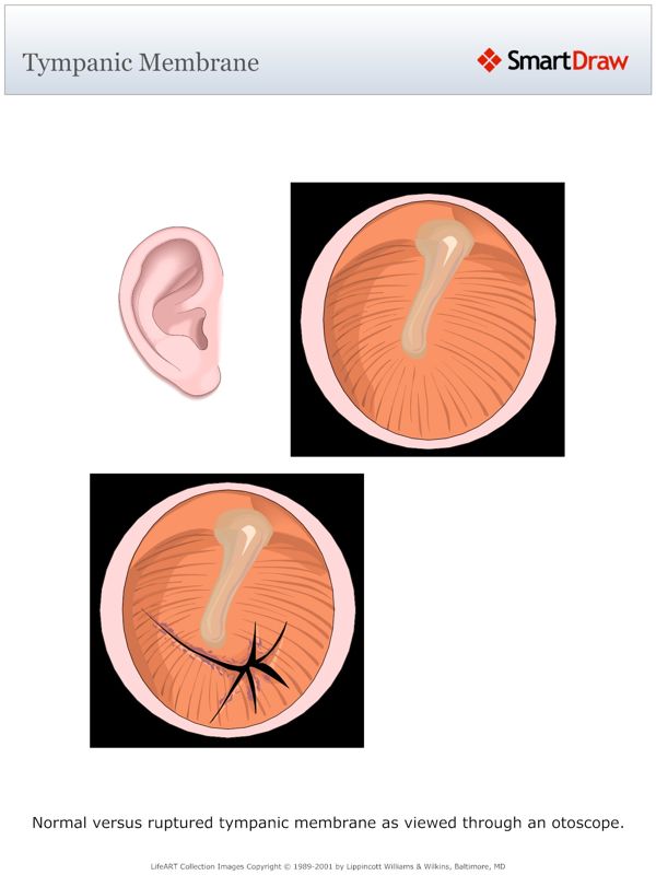 Tympanic_Membrane