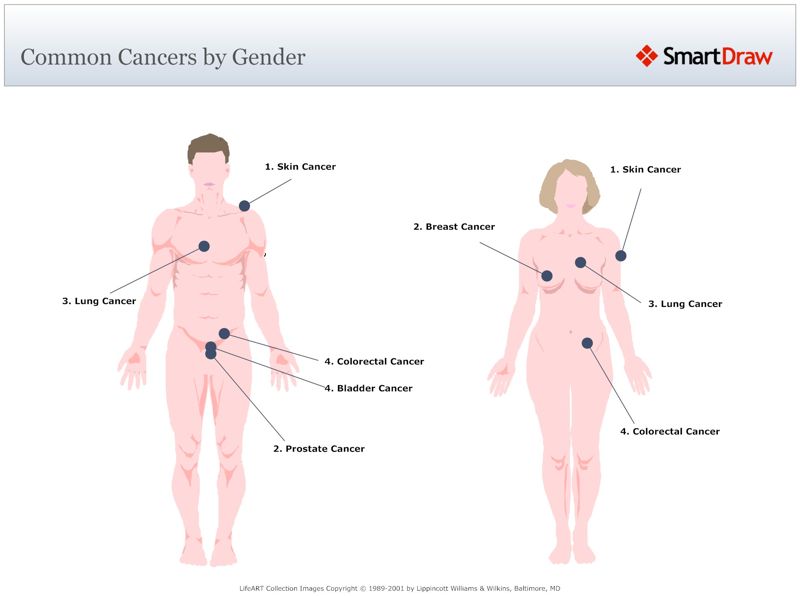 Common_Cancers_by_Gender