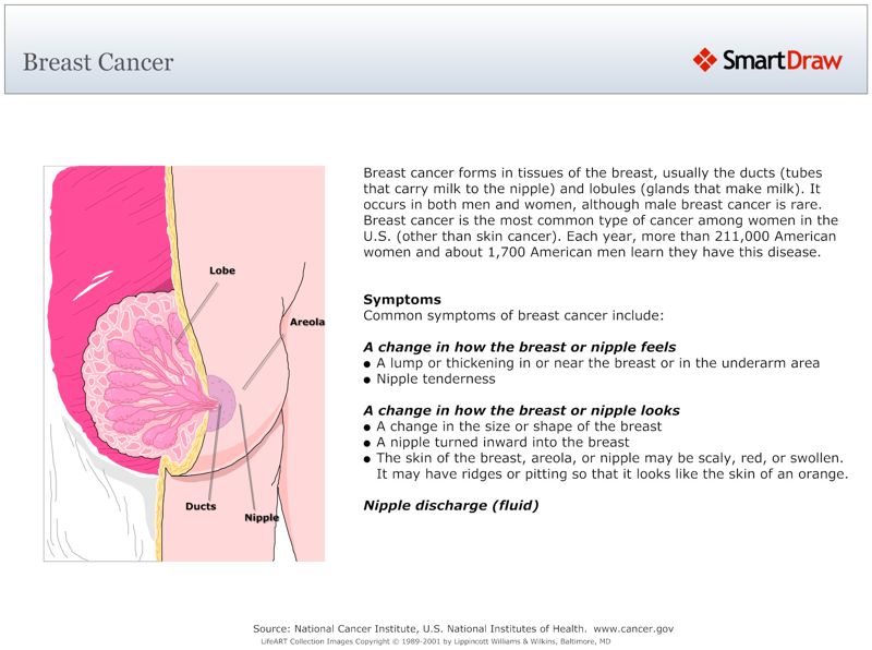 Breast_Cancer