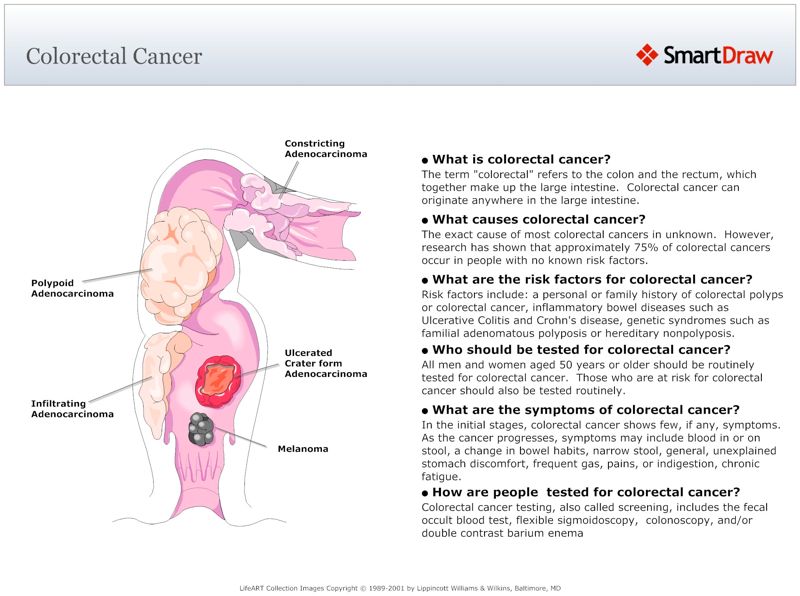 Colorectal_Cancer2