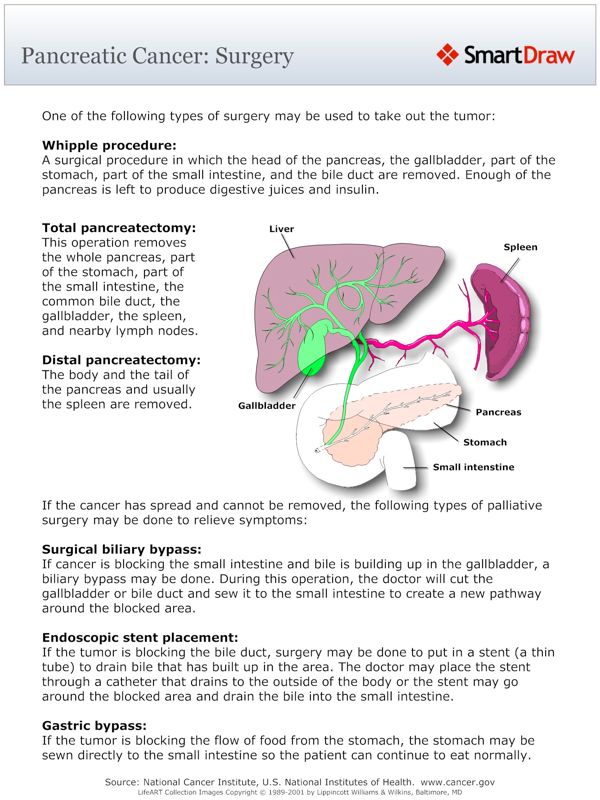Pancreatic_Cancer_Surgery