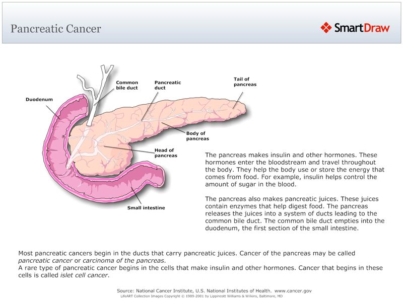 Pancreatic_Cancer