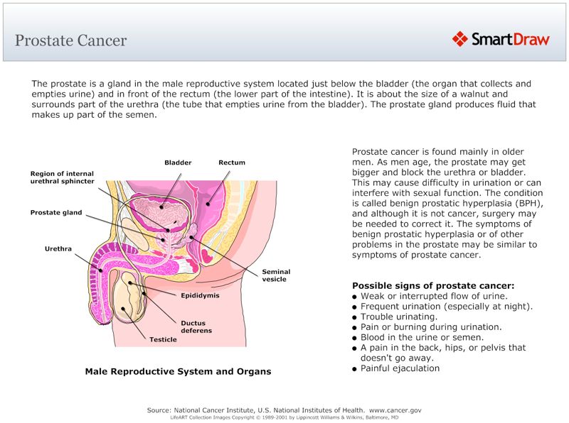 Prostate_Cancer