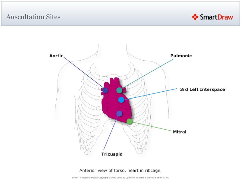 Auscultation_Sites