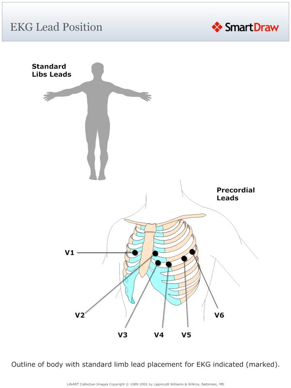 EKG_Lead_Position