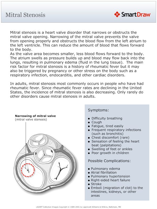 Mitral_Stenosis