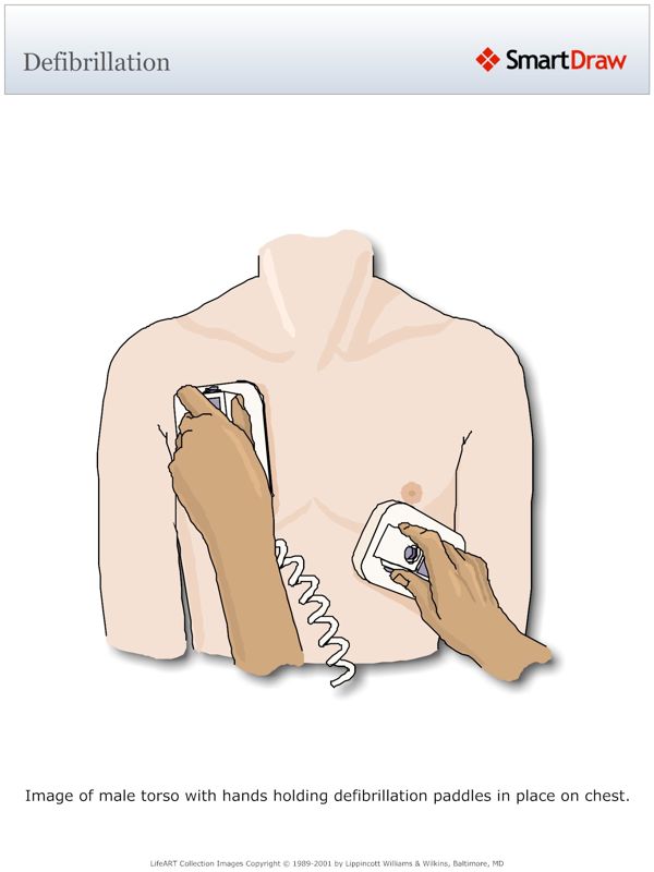 Defibrillation