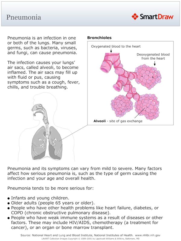 Pneumonia