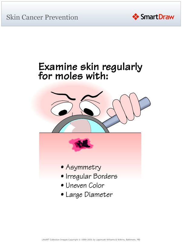 Skin_Cancer_Prevention
