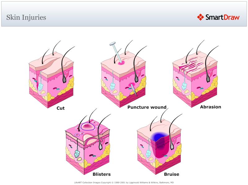 Skin_Injuries