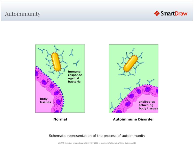 Autoimmunity