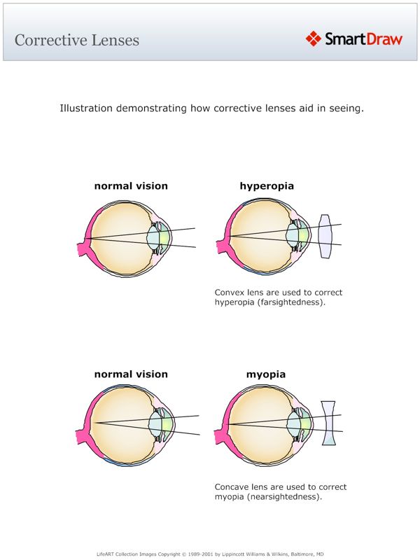 Corrective Lenses