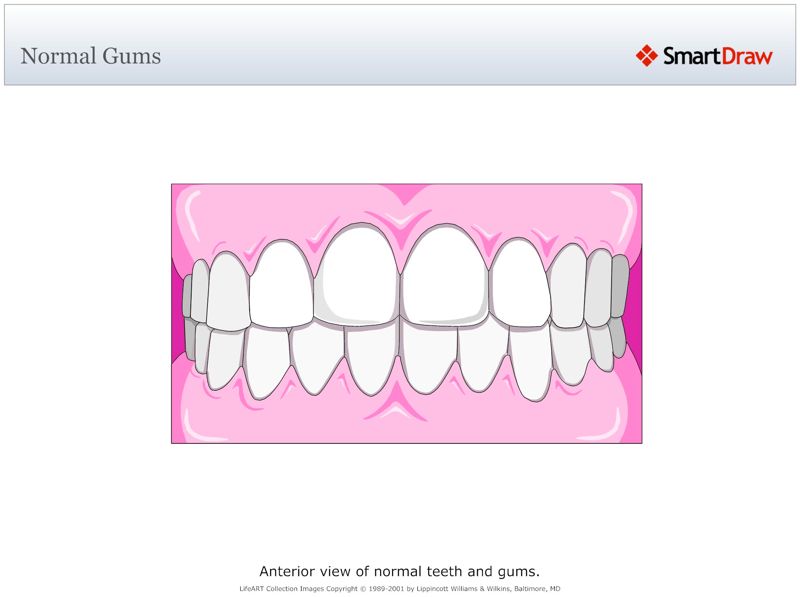 Normal_Gums