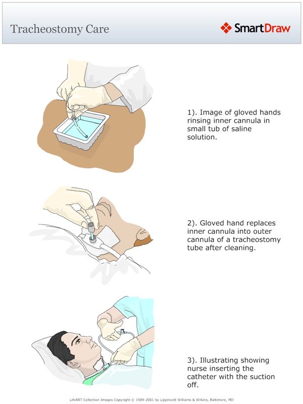 Tracheostomy_Care