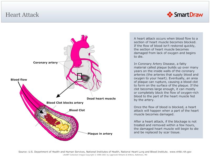 Heart_Attack