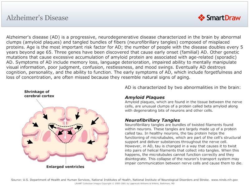 Alzheimer's_Disease
