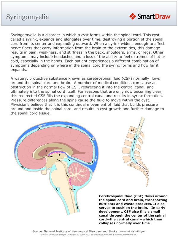 Syringomyelia