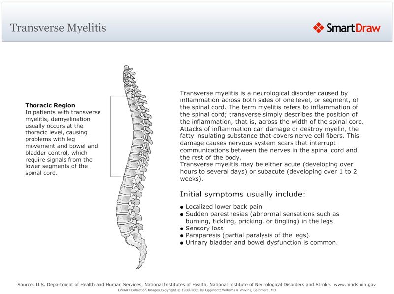 Transverse_Myelitis