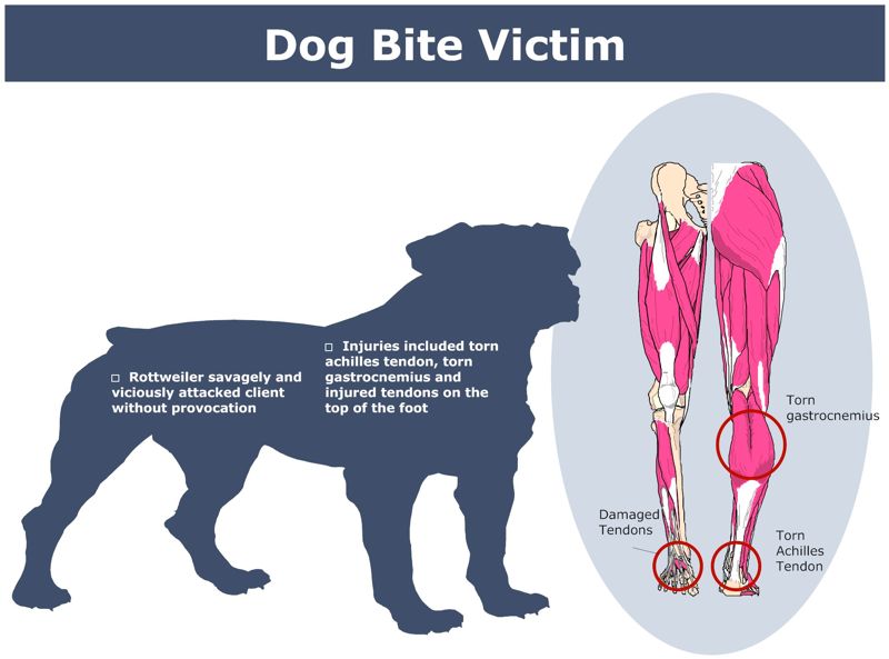 Dog_Bite_Victim