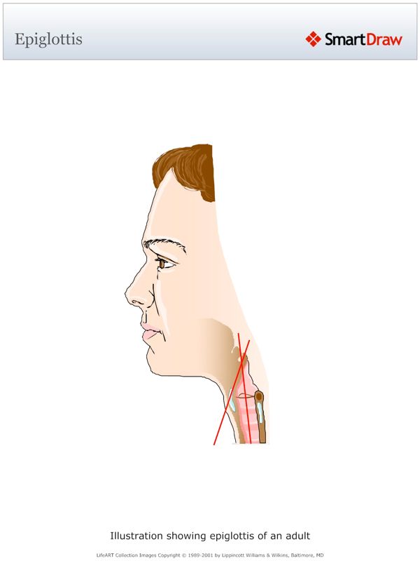 Epiglottis