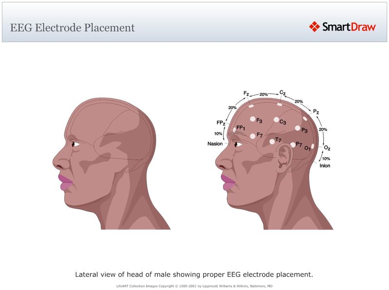 EEG_Electrode_Placement