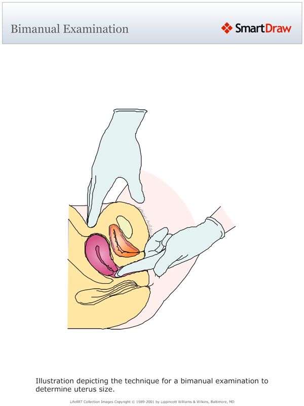 Bimanual_Examination
