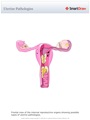 Uterine_Pathologies