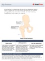 Hip_Fracture