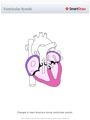 Ventricular_Systole
