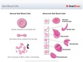 Red_Blood_Cells