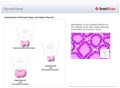Thyroid_Gland