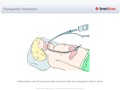 Nasogastric_Intubation2