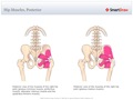 Hip_Muscles,_Posterior
