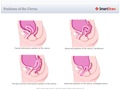 Positions_of_the_Uterus