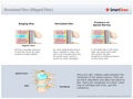 Herniated_Disc_(Slipped_Disc)