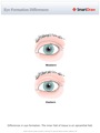 Eye_Formation_Differences