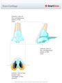 Nose_Cartilage