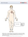 ECG_Principle