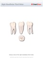 Right_Mandibular_Third_Molar