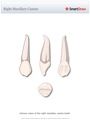 Right_Maxillary_Canine