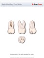 Right_Maxillary_First_Molar