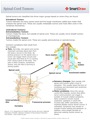 Spinal_Cord_Tumors