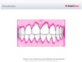Periodontitis